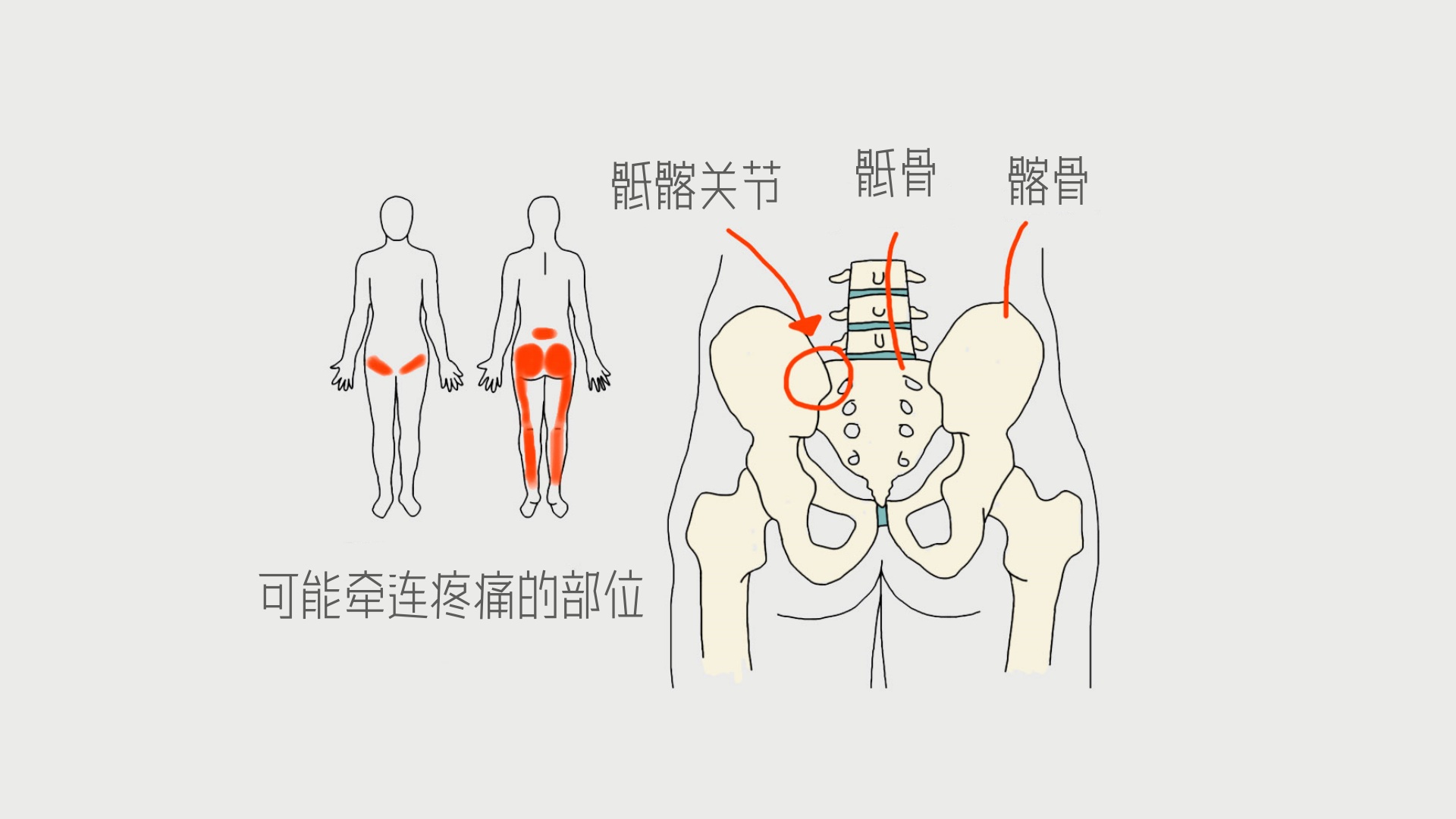 骶髂关节 SIJ