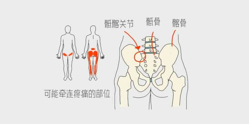 骶髂关节 SIJ